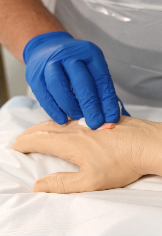 Selecting a cannulation site