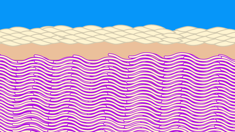 Principles of scar formation simulating a weaker haphazard collagen structure.