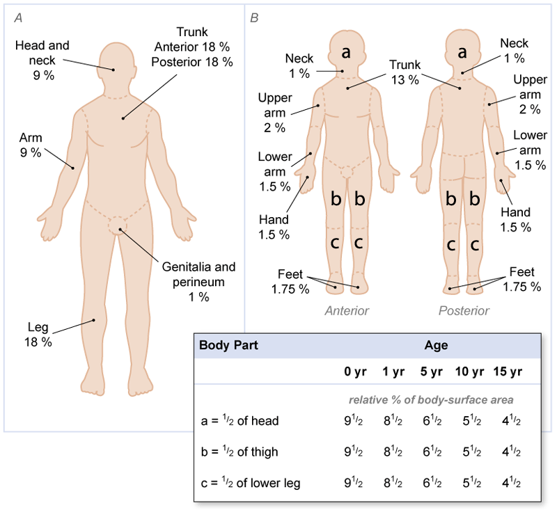 An example of an assessment tool (Lund and Browder) used to measure the percentage TBSA of a burn. Erythema (superficial burn) is not included in measuring the overall TBSA.