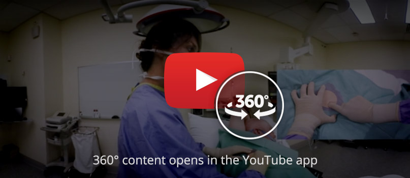 360-ICC-insertion-mobile