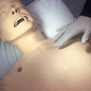 SimMan3G - Pneumothorax