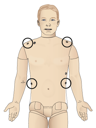 3 Lead ECG positions