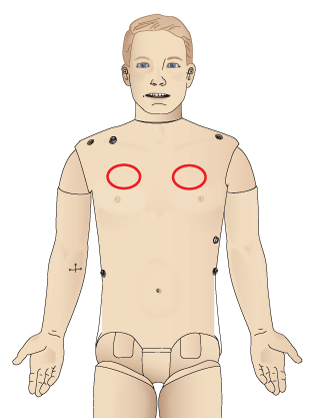 Pneumothorax insertion points