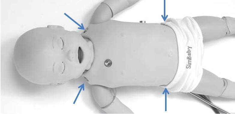 3-Lead-ECG-Locations