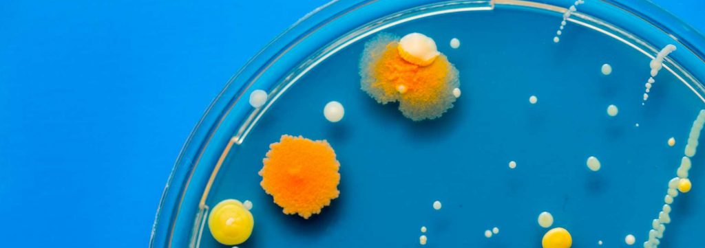 petri dish bacteria growth experiment