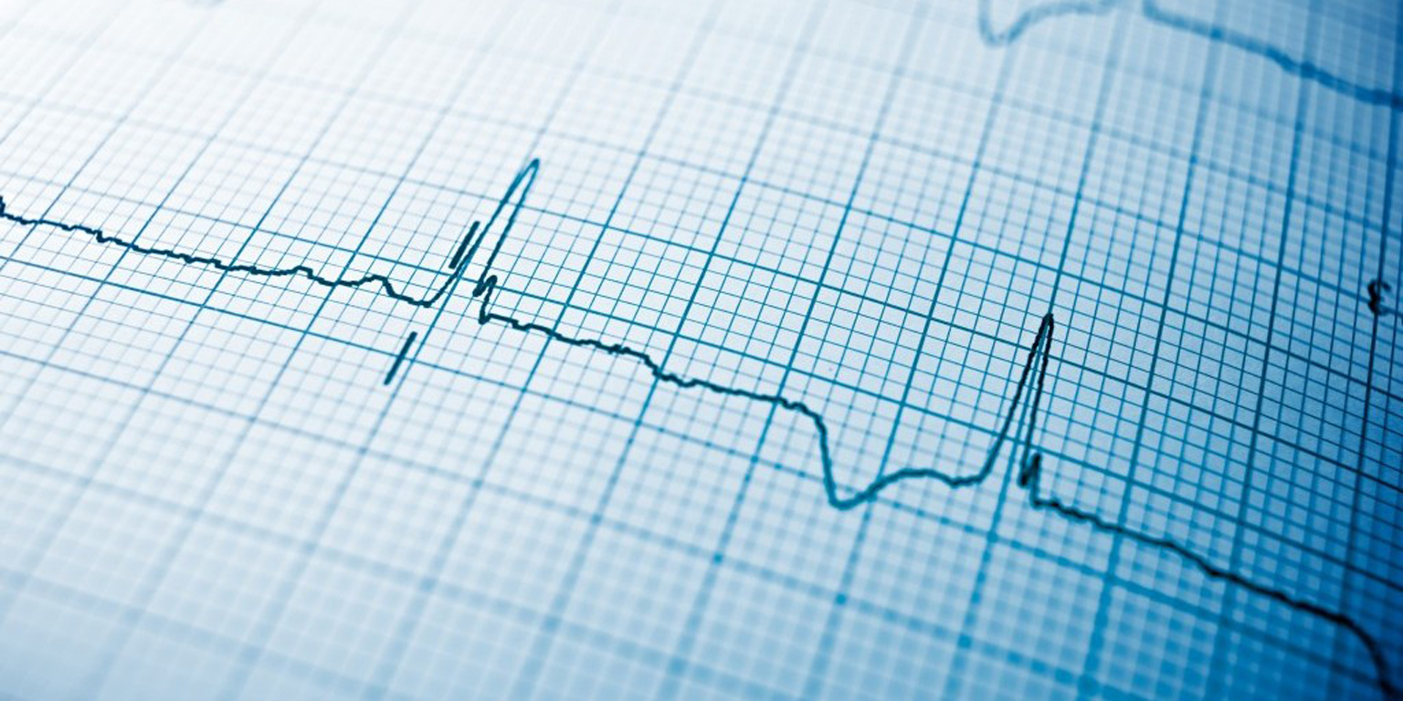 close-up-of-an-electrocardiogram-in-paper-form-1536x768-panorama