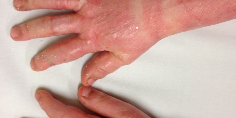 principals of scar mx